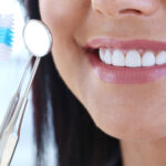 tipos de blaqueamiento dental